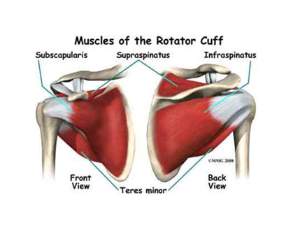 ARTROSZKÓPOS ROTÁTORKÖPENY VARRAT